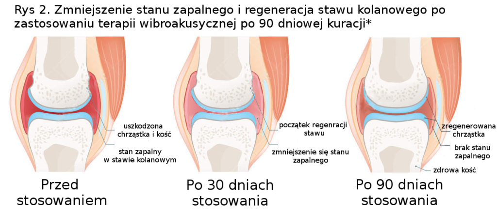 kuracja Vitafonem