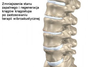 Zmniejszenie stanu zapalnego 
